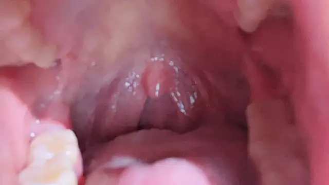 LT-333's cam snapshot