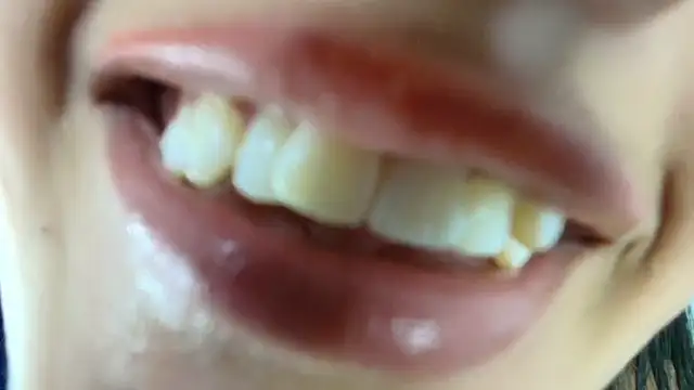 Hinata_21_'s cam snapshot